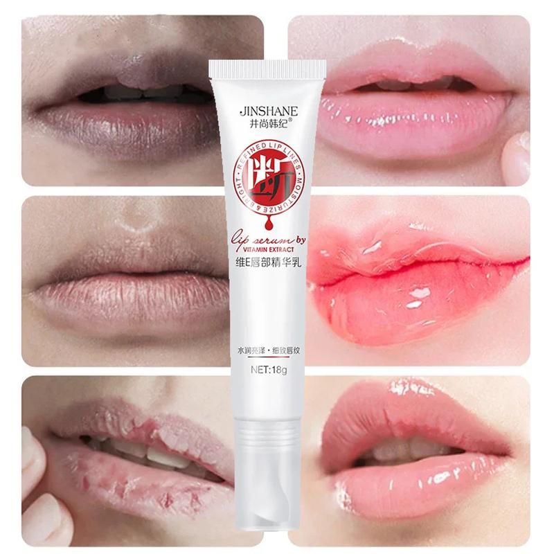 Lips Pink Fresh Lightening Bleaching Cream Reduce Pigmentation Remove Dark Smoke Lips GLow Moisturizer Essence Lip Care