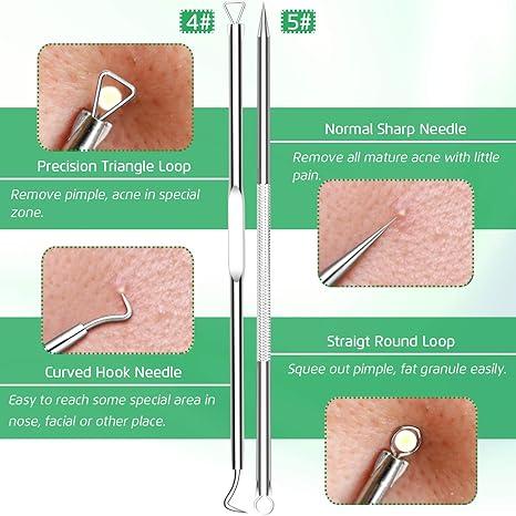 5PCS Blackhead Remover Comedone Extractor, Curved Blackhead Tweezers Kit, Pimple Acne Blemish Removal Tools Kit. ear blackhead removal products