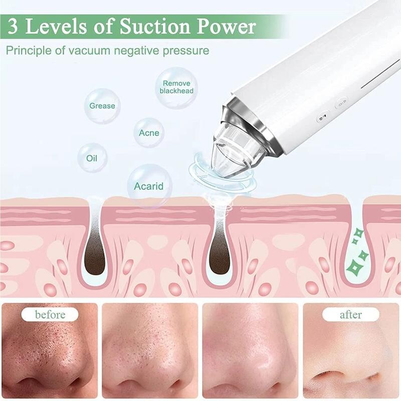 WiFi Visible Facial PoreCleanser with HD Camera Pimple AcneComedone Extractor Kit with 6 Suction HeadsElectric Blackhead Suction blackhead extractor