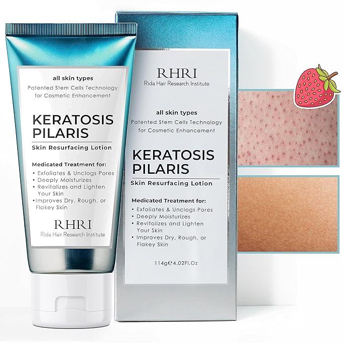 Rida Hair Research Institute Keratosis Pilaris Lotion with Glycolic Acid, AHA & BHA Exfoliating | Strawberry Legs, KP & Ingrown Hair Treatment | Bumpy Skin Body Lotion | Moisturizing Cream for Redness, Dry, Rough & Flakey Skin