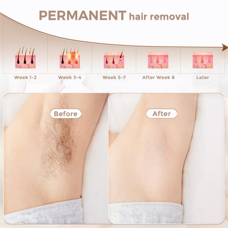 At-Home IPL Hair Removal Device,Hair Root Elimination,Unlimited Flashes,FDA Cleared, Comfort epilator hair removal machine