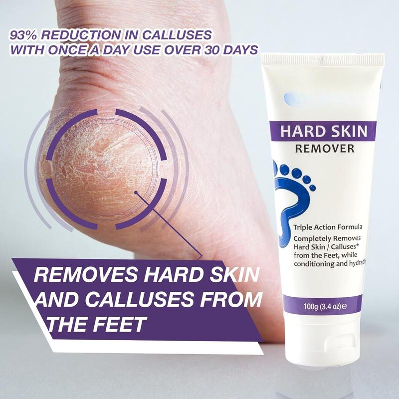 Foot Cream For Hard , Helps Calluses and Corn Removal While Leaving Soft Smooth , Hydrating and Conditioning Triple Action Formula With Aloe Vera, 3.4 Ounce Tube