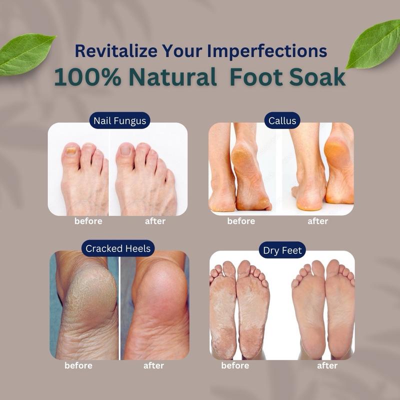 100% Natural Antifungal Foot Soak for Fungus, Odor & Softening - Beauty & Personal Care Therapy