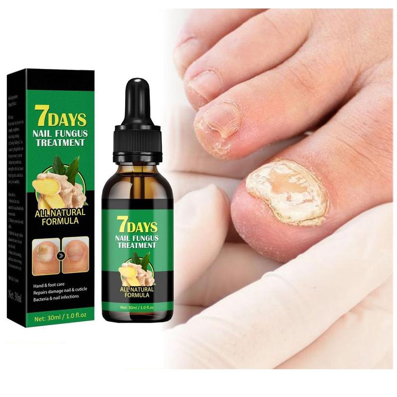 3pcs Ginger Nail Treatment for Daily Care & Manicure, Antibacterial Formula, Nail Support & Manicure Essential