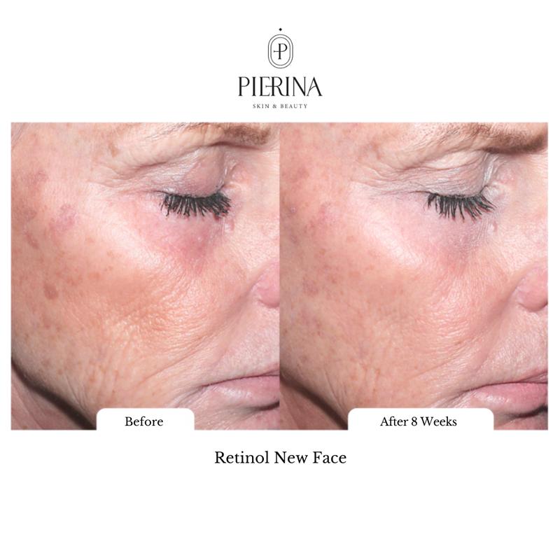 New Face Advanced Retinol 0.5% Serum - Reduces Fine Lines, Boosts Collagen, Improves Skin Texture, and Promotes a Smoother, More Even Complexion Skincare Facial