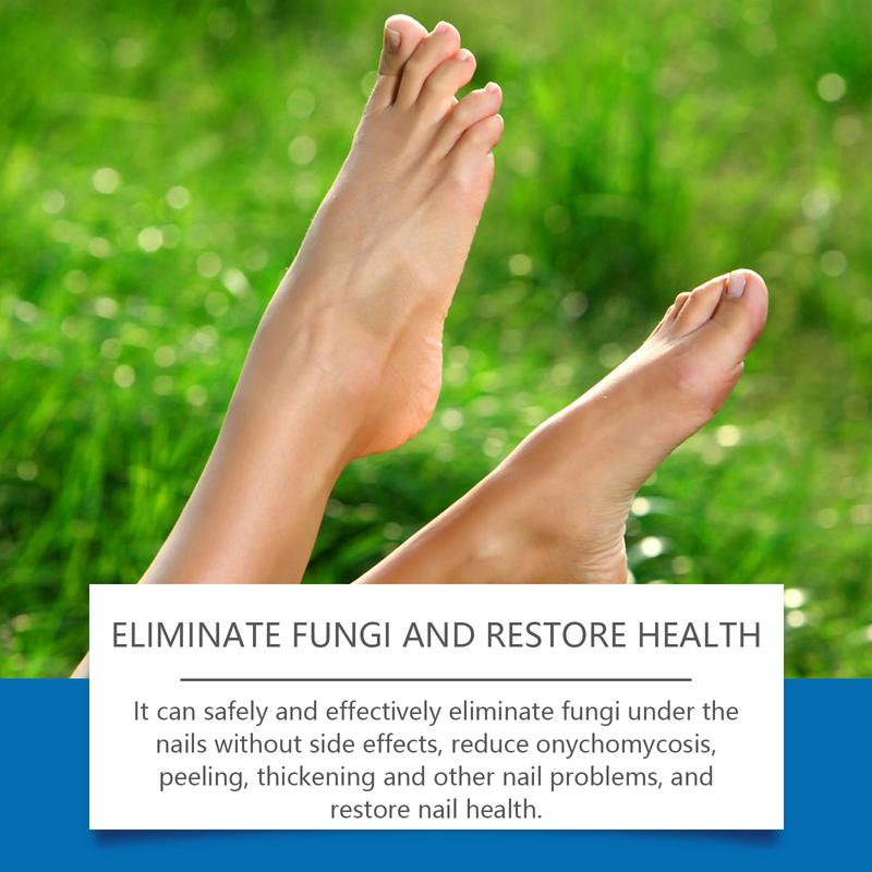 Fungus Toenail Eradicating Laser Device，Fungus Toenail Eradicating Laser Device；Nail Care Products；Nail Products Ginger Foot toenail laser therapy toenail laser device toenail treatment foot care products nail fungus