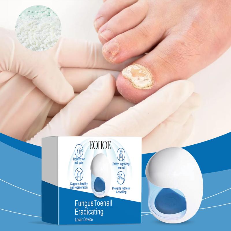 Fungus Toenail Eradicating Laser Device，Fungus Toenail Eradicating Laser Device；Nail Care Products；Nail Products Ginger Foot toenail laser therapy toenail laser device toenail treatment foot care products nail fungus