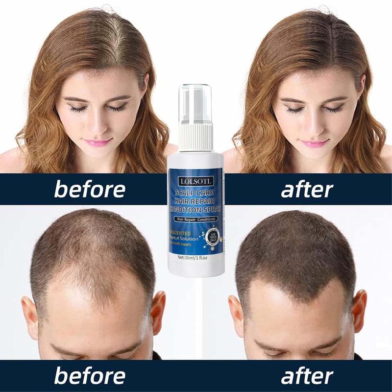 5% Minoxidil Hair Gel for Thinning Hair Growth.