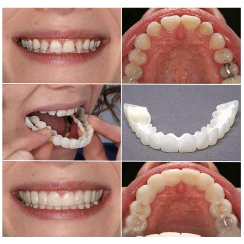 4-pieces, Comfortable And Flexible Disposable White Artificial Braces With Dental Veneer For Upper And Lower Teeth, For Both Men And Women