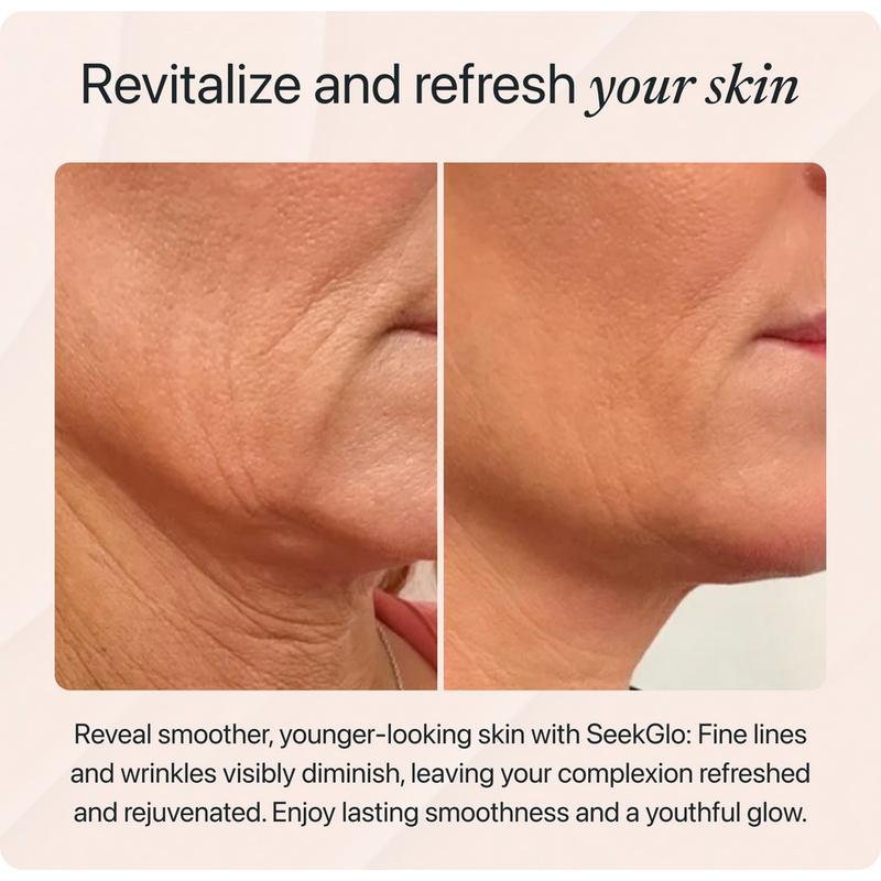 SeekGlo MicroNeedle Infusion Anti-Aging System