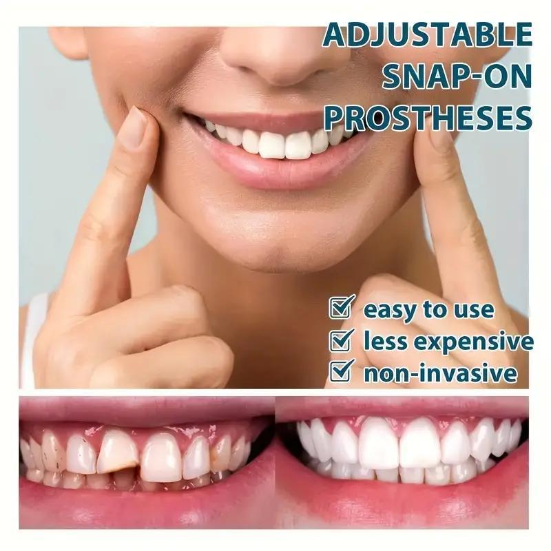 4-pieces, Comfortable And Flexible Disposable White Artificial Braces With Dental Veneer For Upper And Lower Teeth, For Both Men And Women