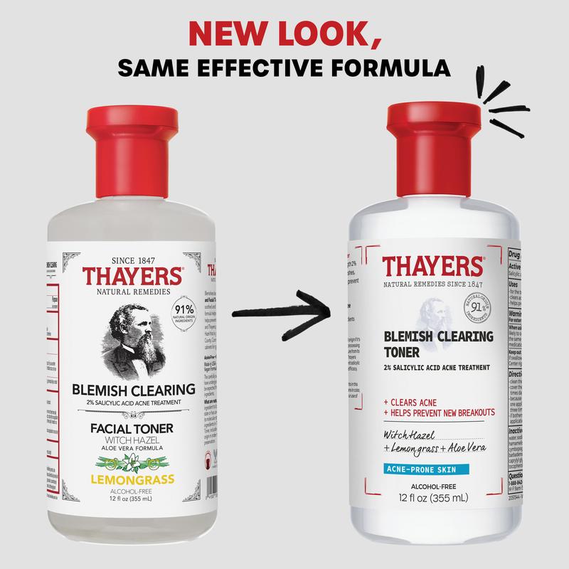 Thayers Natural Remedies Blemish Clearing Toner – 2% Salicylic Acid Acne Treatment, Clarify & Balance Skin for Clearer Complexion!