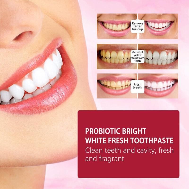 YAYASHI SP4 Probiotics Teeth Whitening,Helps Remove Surface Stains,Whitens Teeth,Deep Cleaning Care,Strengthens Tooth Enamel,Protects Against Cavities healthy toothpaste pasta dental oral health natural oral