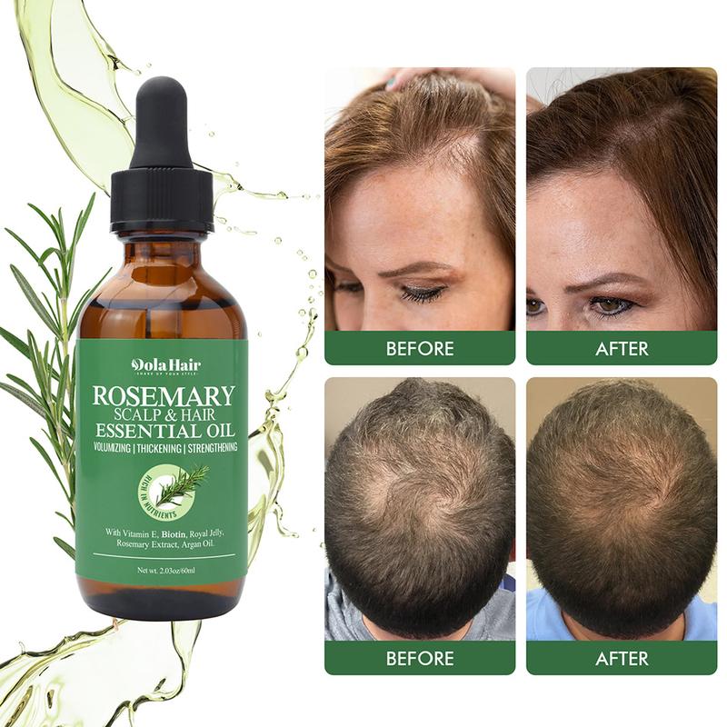 Organic Rosemary Oil For Hair Care, Natural Scalp Hair Oil With Essentials, Rosemary Oil Nourishing Treatment For Split Ends, Dry Scalp All Hair Type