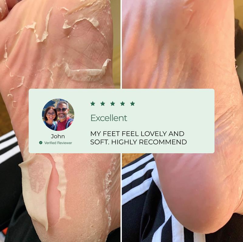 Plantifique Men Foot Peel Mask - Foot Mask for Dry Feet - Callous Remover - Exfoliate - Moisturize - Exfoliator Nail Callus Remover Peeling Moisturizer Hydrate - Improves Moisture - Hydrating Mask - Moisturizing