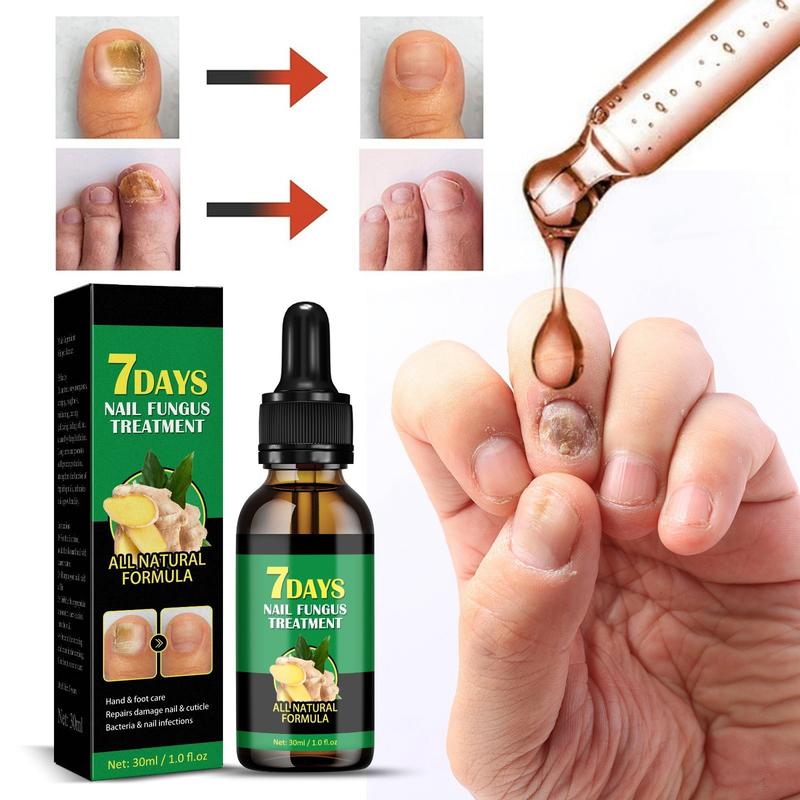 Ginger Nail Treatment for Daily Nail Care and Support - Antibacterial Formula - Manicure Essential