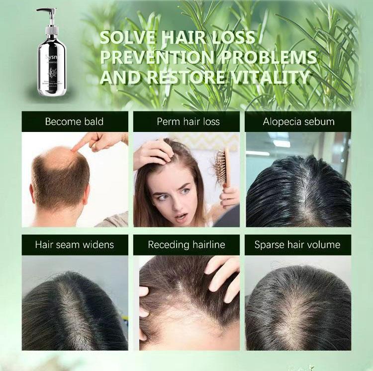 Sysni Organic Rosemary Shampoo and Tea Tree Special Shampoo, keratin nourIshing shampoo ,Promote Hair Growth, Strengthening Shampoo, Prevent Hair Loss Cleansing Shampoo,Deep Cleans, Refreshes Scalp, For All Hair Types, Especially Oily Hair