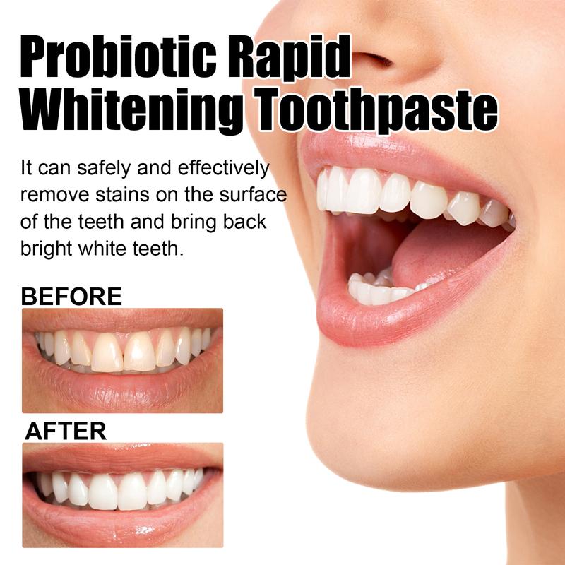 Probiotic Rapid Whitening Toothpaste;Whitening Toothpaste;Probiotic Whitening Toothpaste tooth stain niacinamide toothpaste