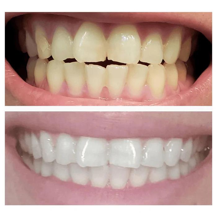 Snow Teeth Whitening Magic Powder Infused with Calcium Carbonate for White Teeth  Lavender & Mint