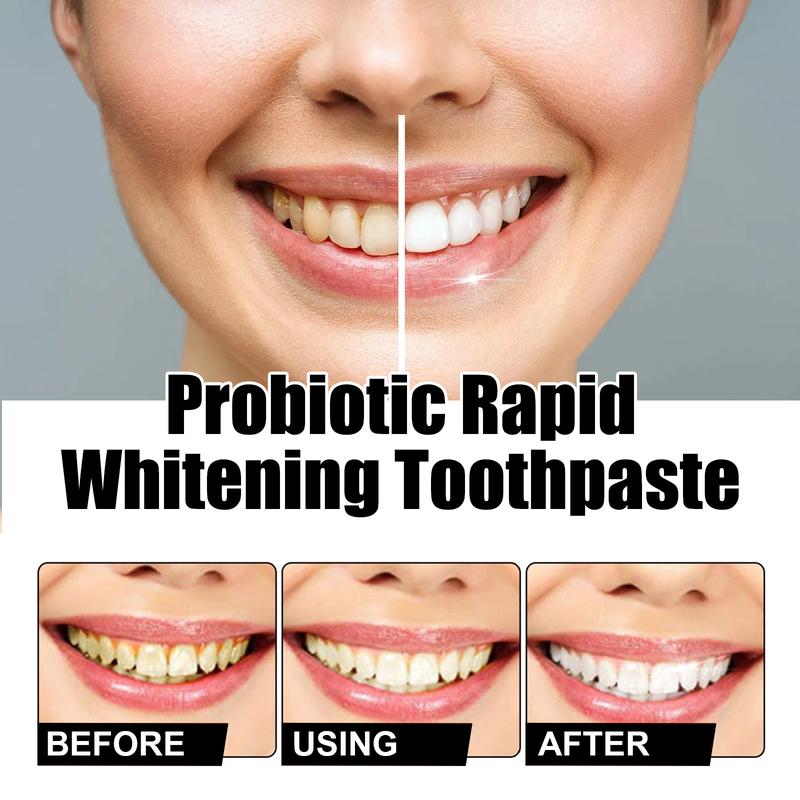 Probiotic Rapid Whitening Toothpaste;Whitening Toothpaste;Probiotic Whitening Toothpaste tooth stain niacinamide toothpaste