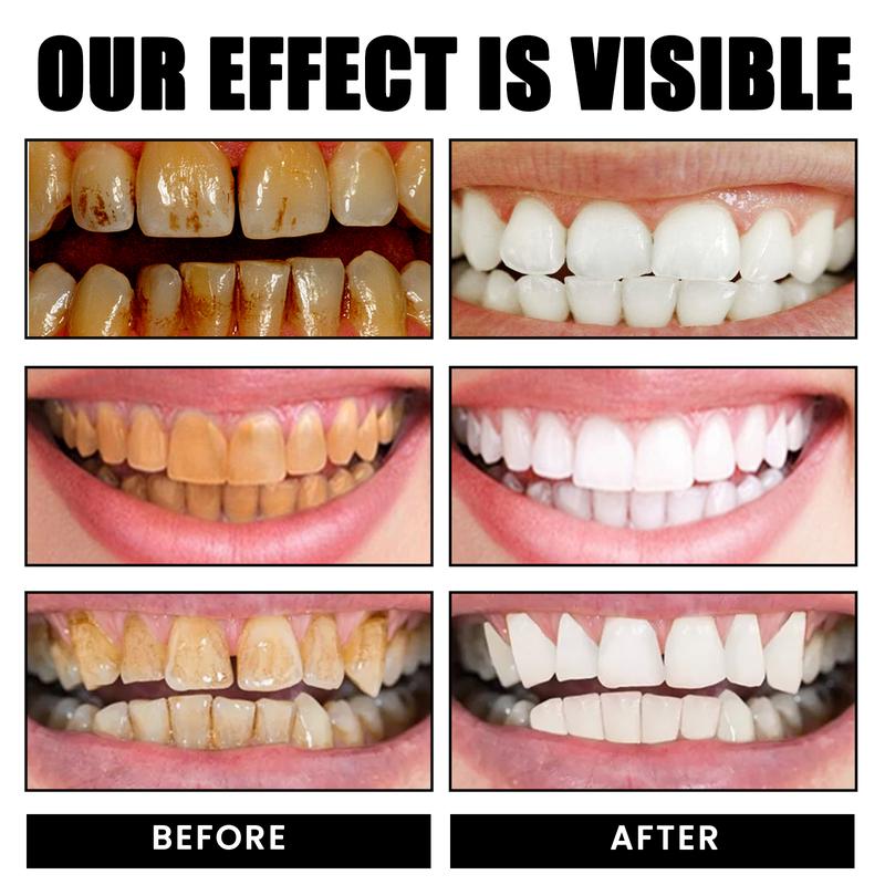 Probiotic Rapid Whitening Toothpaste;Whitening Toothpaste;Probiotic Whitening Toothpaste tooth stain niacinamide toothpaste