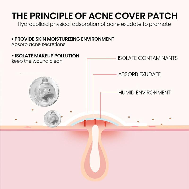 Hydrocolloid Acne Patches, 4 Boxes Portable Acne Cover Patches, Facial Skin Care Patches, Skin Care Products for Women & Men