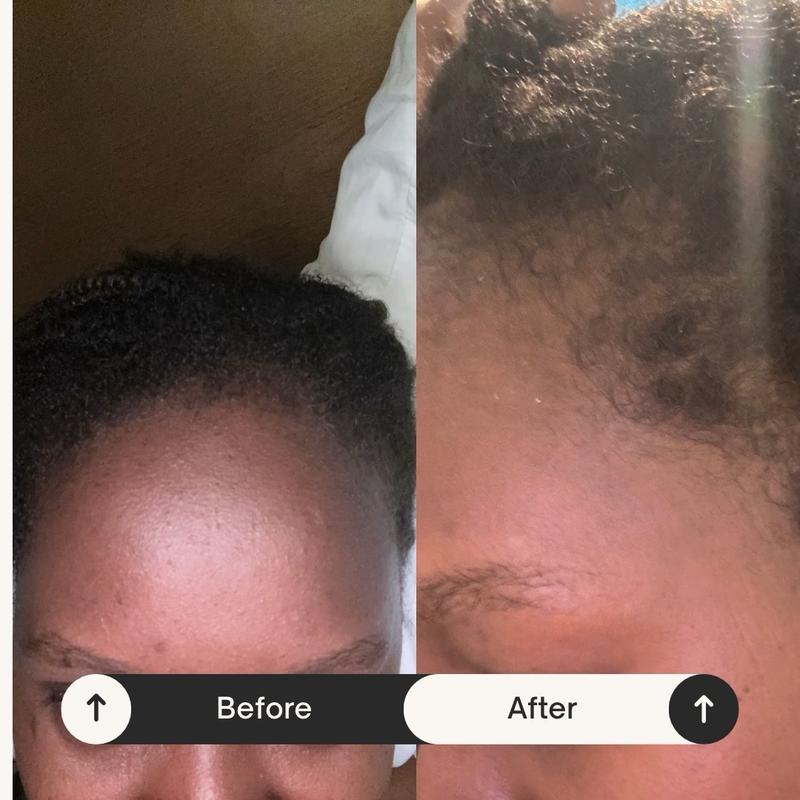 Eman's Secret Edges Growth Serum for Regrowth - Hair Treatment