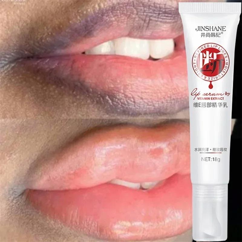 Lips Pink Fresh Lightening Bleaching Cream Treatment Remove Dark Smoke Lips Lip Balm Whitening Moisturizer Nourishing Essence