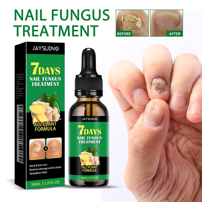 Ginger Nail Care Liquid Repair Hand & Foot Nail Care Soft Nail Shine Nail Moisturising Liquid Grey Nail  Manicure ginger nail  Comfort Nail Art